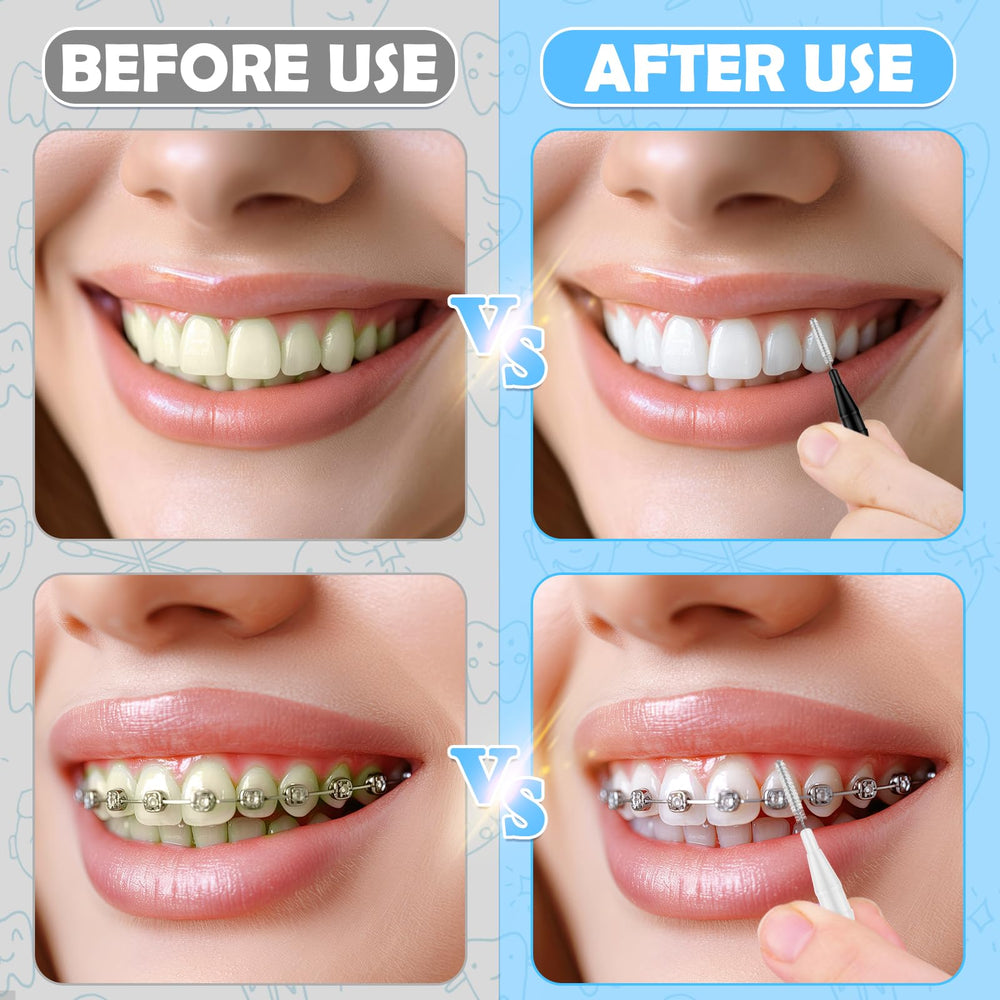 Close-up of 360° bendable interdental brush head for braces