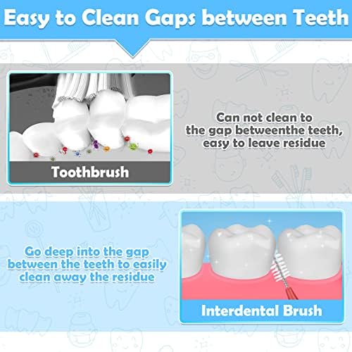 Interdental brush cleaning between teeth near braces