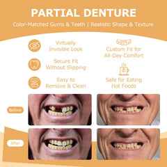 BPA-free safe materials used for dentures