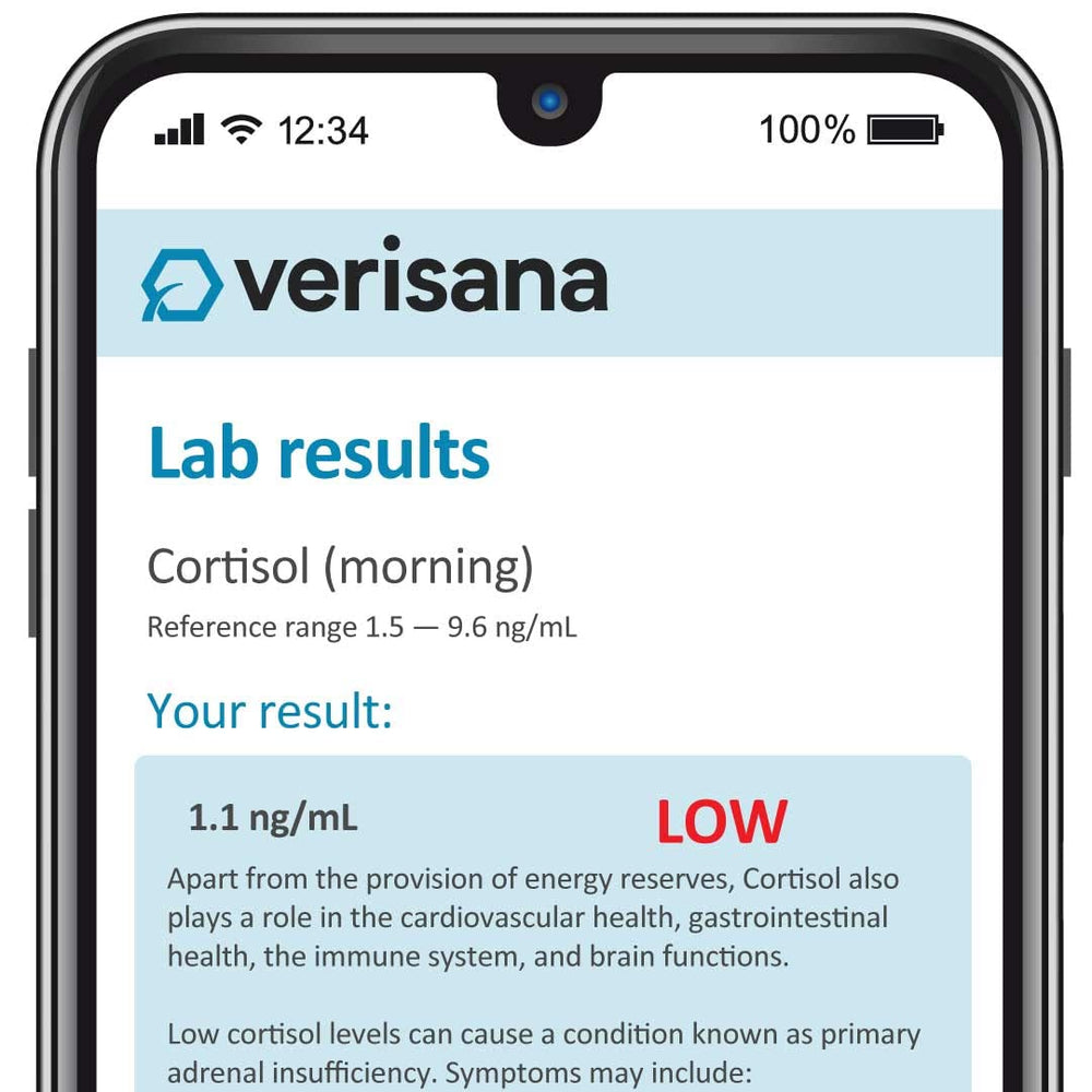 Saliva cortisol test kit used to measure cortisol levels throughout the day.