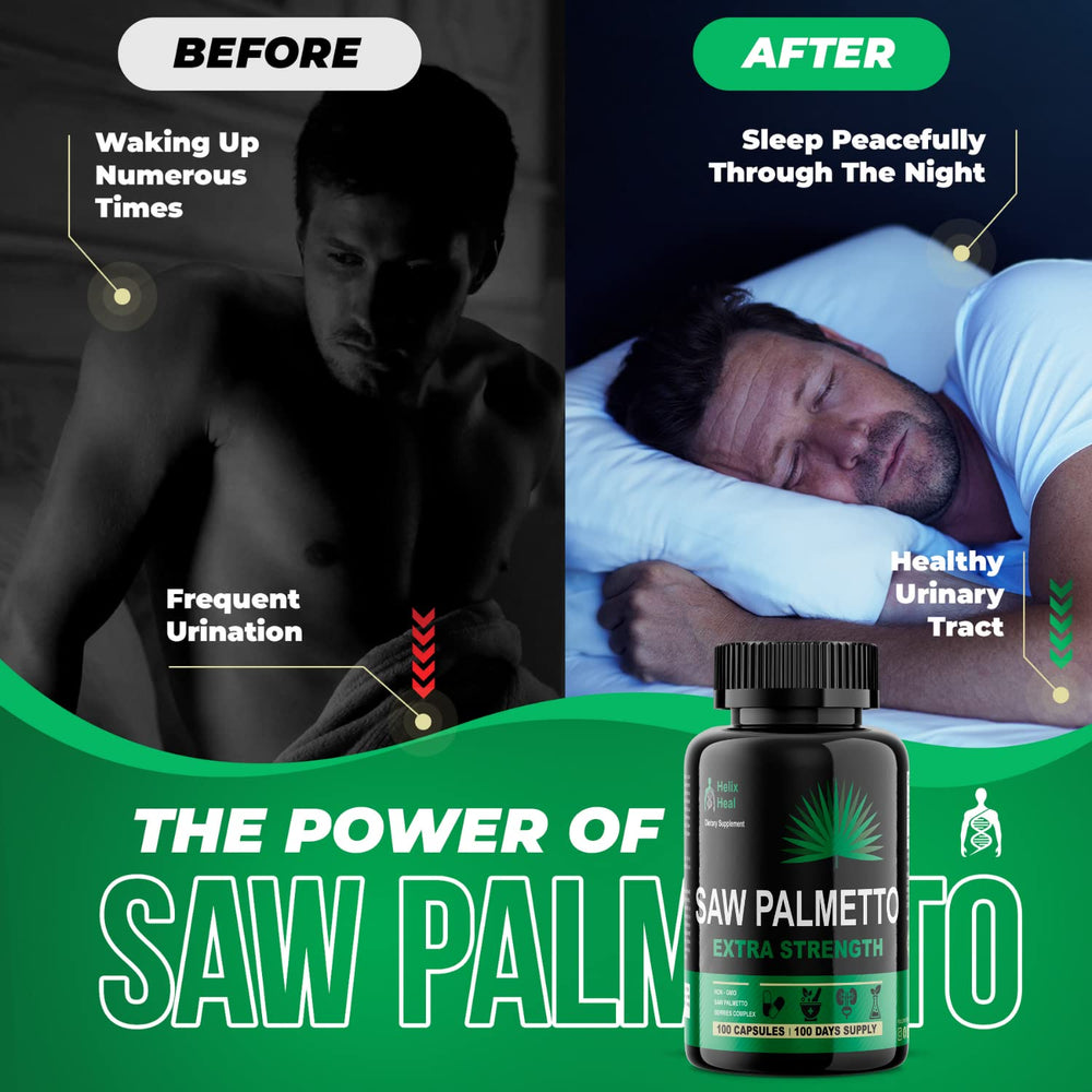 Natural DHT blocker with Saw Palmetto for Men