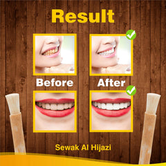 Sewak Al Hijazi Miswak pack inside box packaging