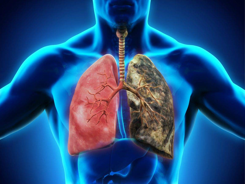 Vitamin K2 and Vitamin D3 synergy for lung protection