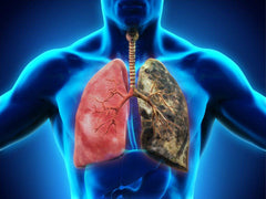 Vitamin K2 and Vitamin D3 synergy for lung protection