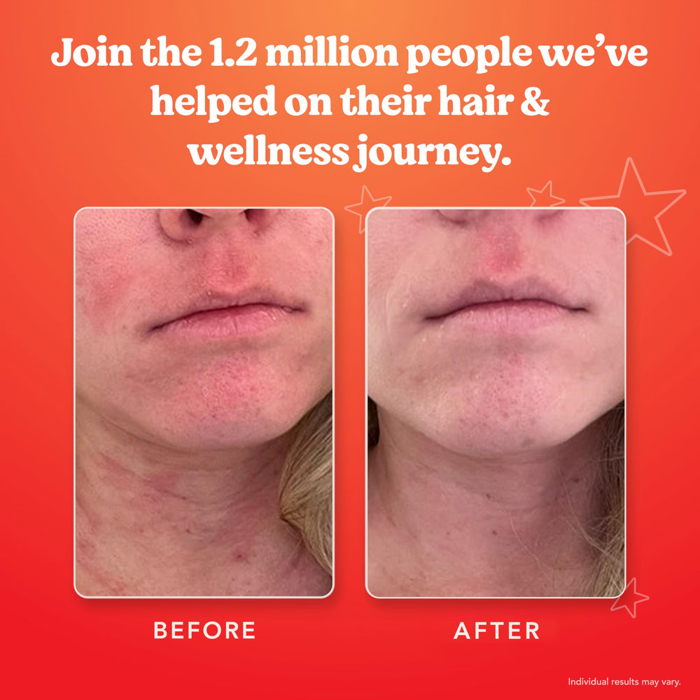 Cruelty-free badge on SKINtamin packaging