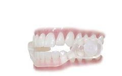Side profile of SleepRight Secure-Comfort dental guard