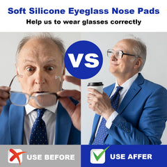 SMARTTOP nose pads product box and contents