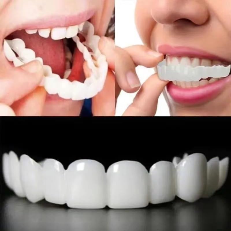 Top and bottom smile enhancer set in open position