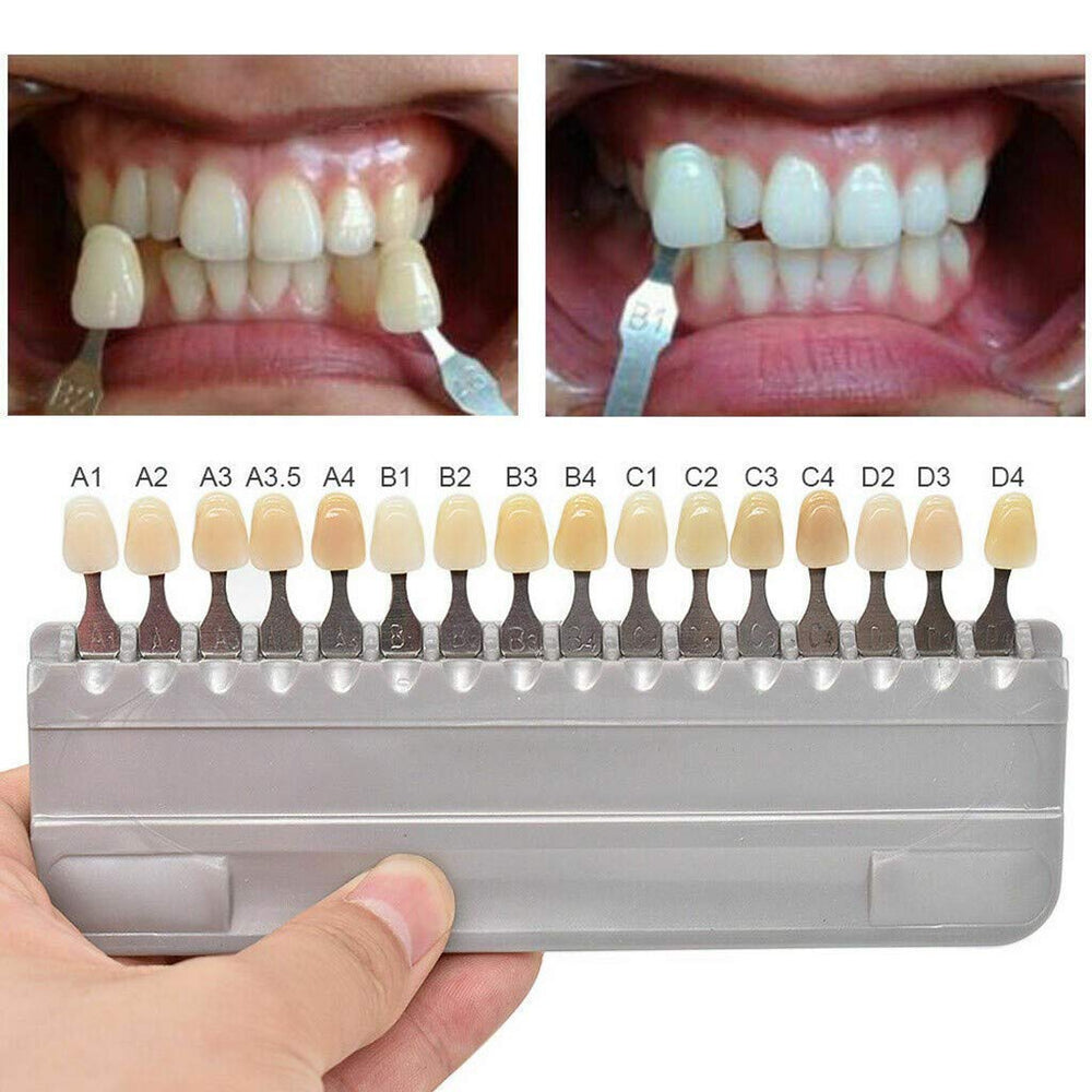Tracking whitening effect with shade guide coloration