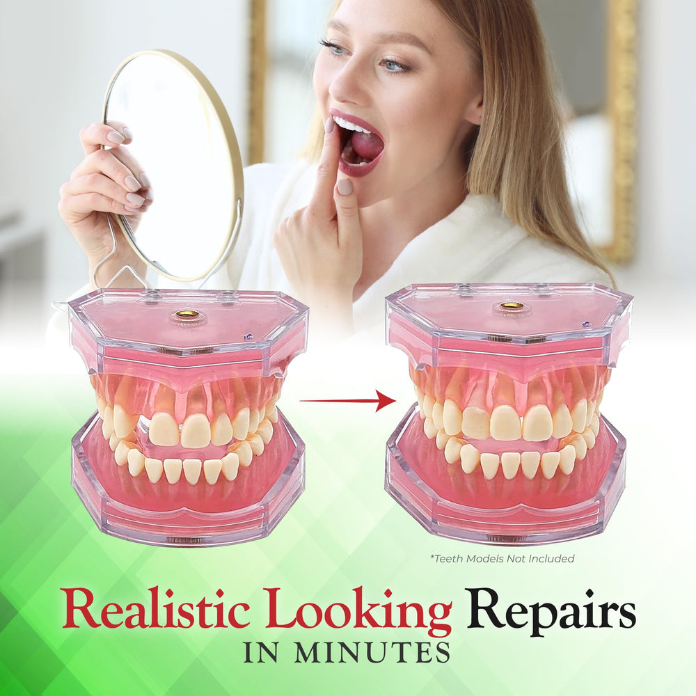 Temporary tooth repair using SmileFix for missing tooth