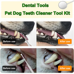 Teeth stain remover tool in stainless steel kit