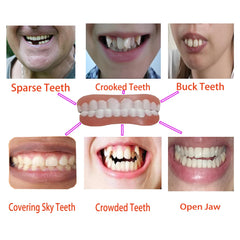 Precision tweezers included in Smileheven kit