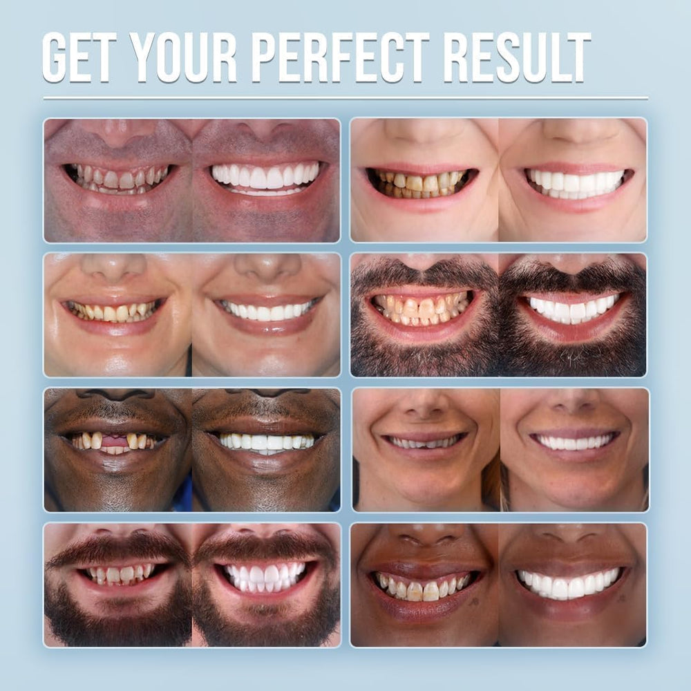 Snap-on dentures demonstrating adjustable, comfortable fit