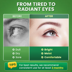 Sodium hyaluronate for ocular comfort