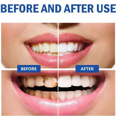 SP10 toothpaste packaging and lifestyle shot
