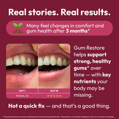 180-count bottle of Strong Jaw Gum Restore