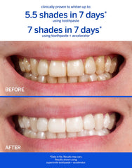 Close-up of Supersmile toothpaste tube – image 3
