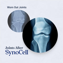 Graphic of Boswellia, Quercetin, and MSM natural ingredients used in Synocell