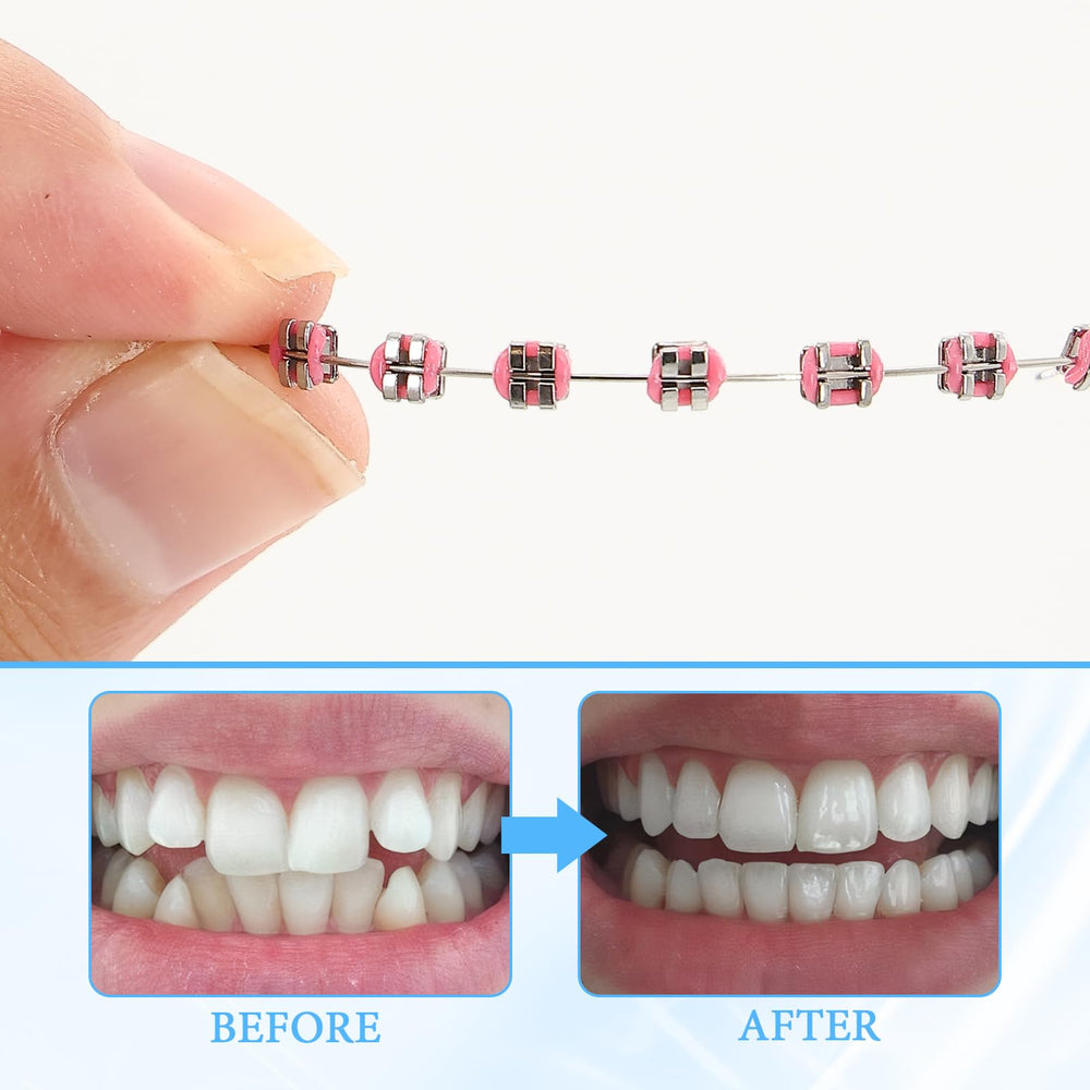 Teeth braces model for orthodontic education Rose Red