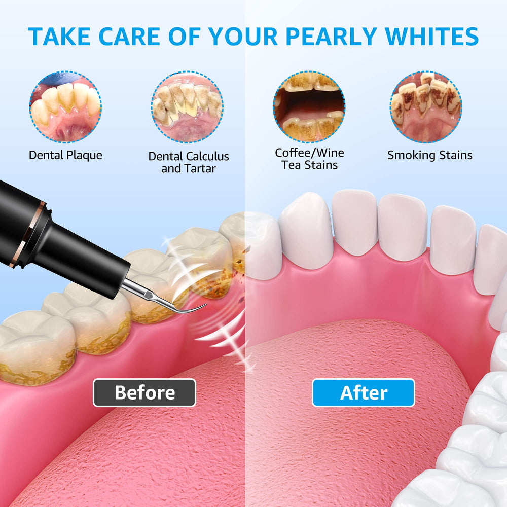 Surface cleaning head for dental scaler