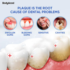 All components of the Teeth Cleaning Whitening Kit displayed together