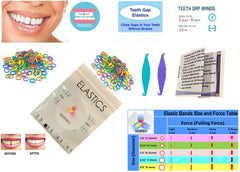 Close-up of mixed-color rubber bands for teeth gap closing