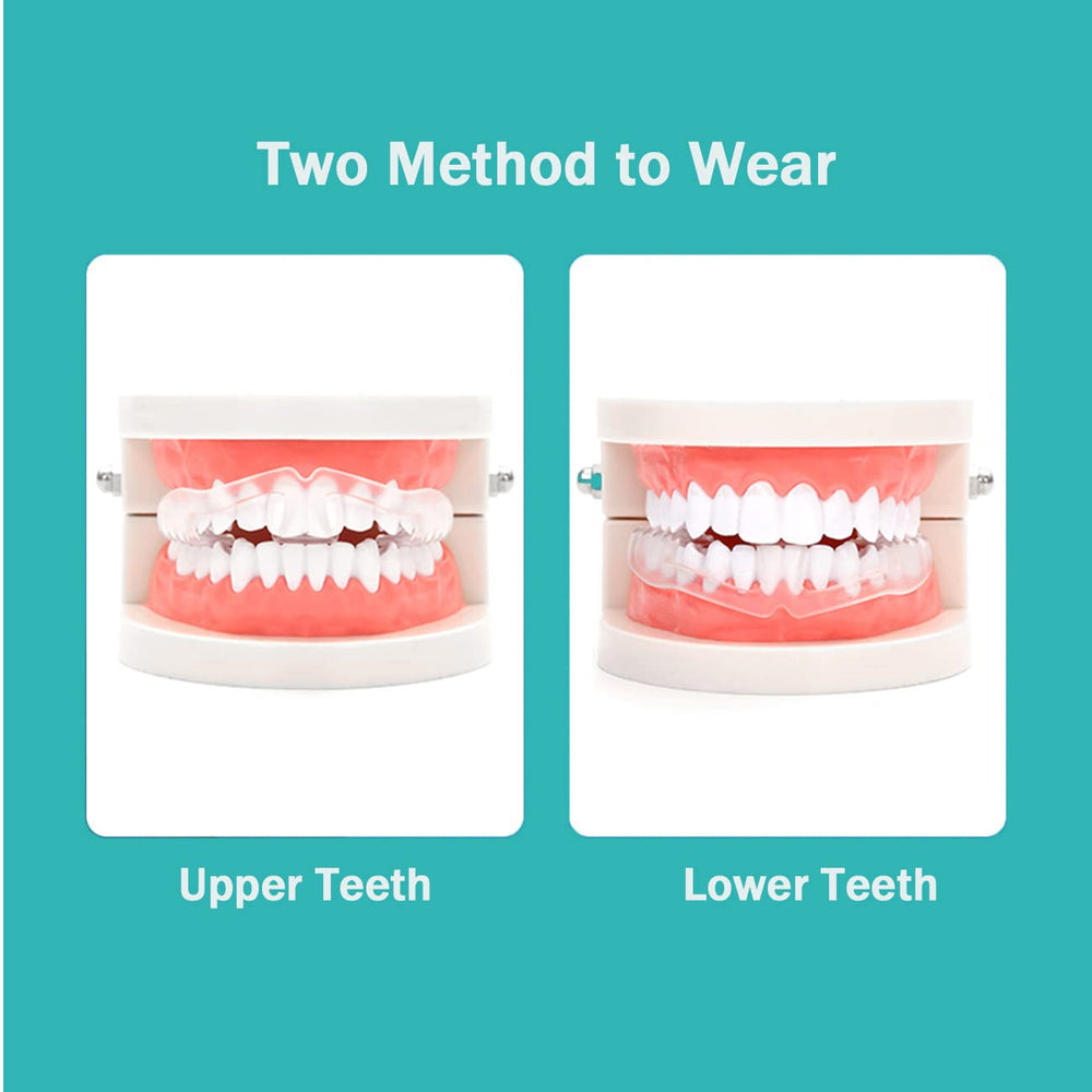 Brace-friendly anti-grinding mouth guard