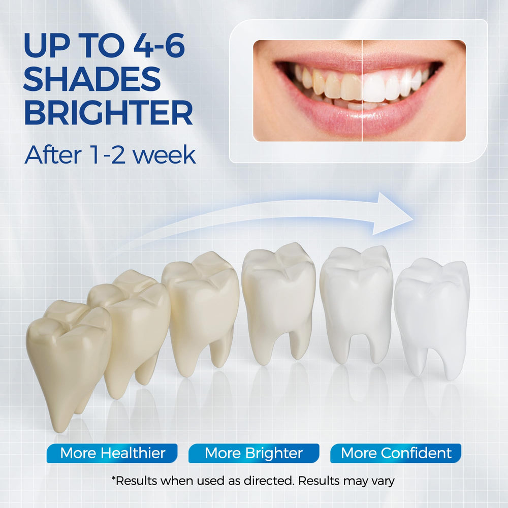 Whitening pen gel being applied to a tooth