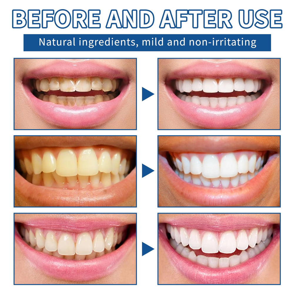 Bright smile after whitening