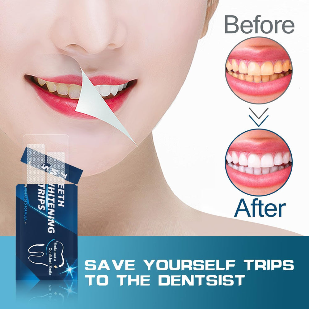 Whitening strips being applied to teeth