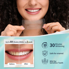 Close-up of whitening strips applying to teeth