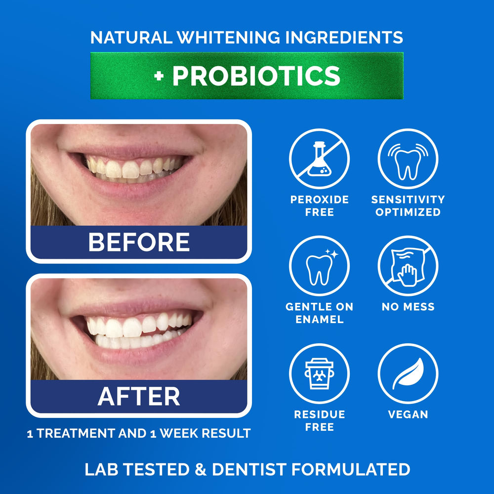 Whitening strips staying in place for up to two hours