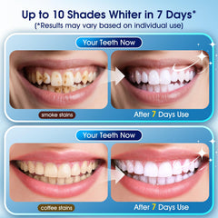 Three whitening pens and two desensitizing pens