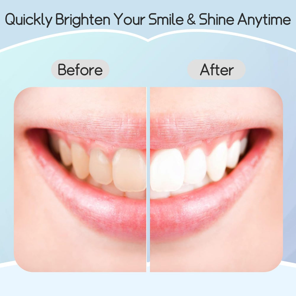 Bright, white smile after using Teeth Whitening Strips
