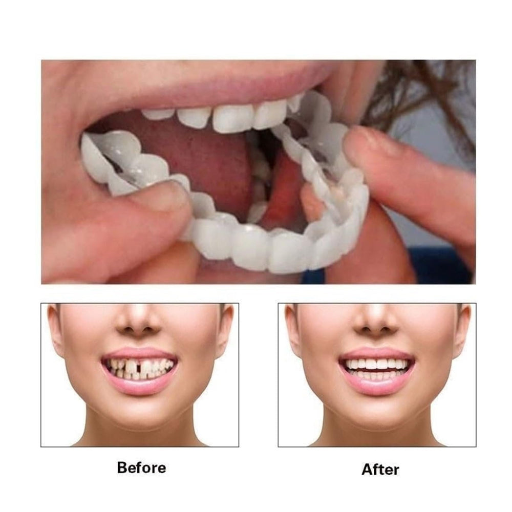 Aligners ready to wear after cleaning
