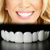 Temporary Adjustable Smile Support – 2 Pairs with top and bottom included, front view