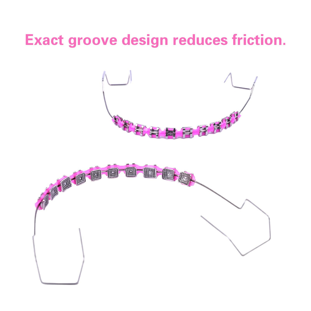 Blue clip-on braces showing metal brackets and ligatures