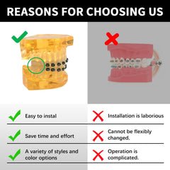 Orthodontic teaching prop displayed on dental model for students