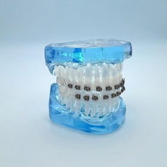 Front view of the black teeth retainer kit