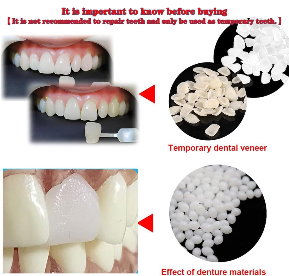 Thermal fitting beads and granules components laid out