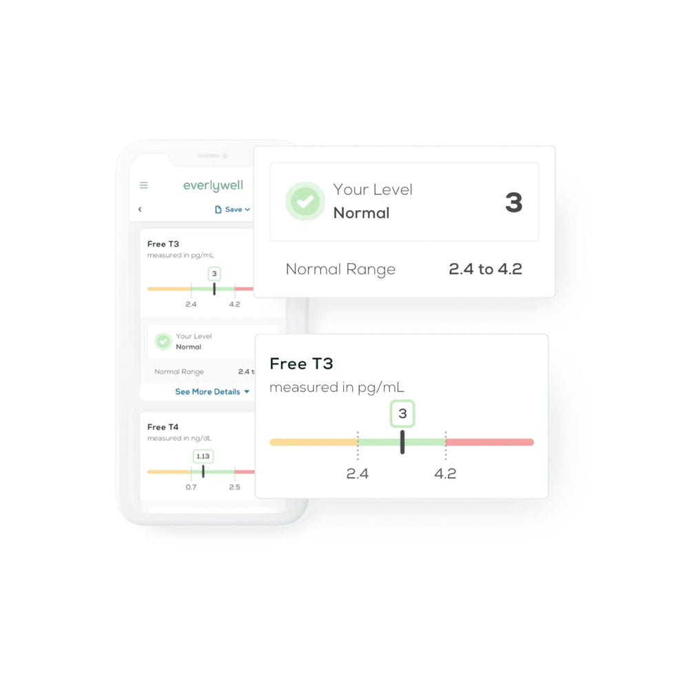 Thyroid antibodies TPO testing image