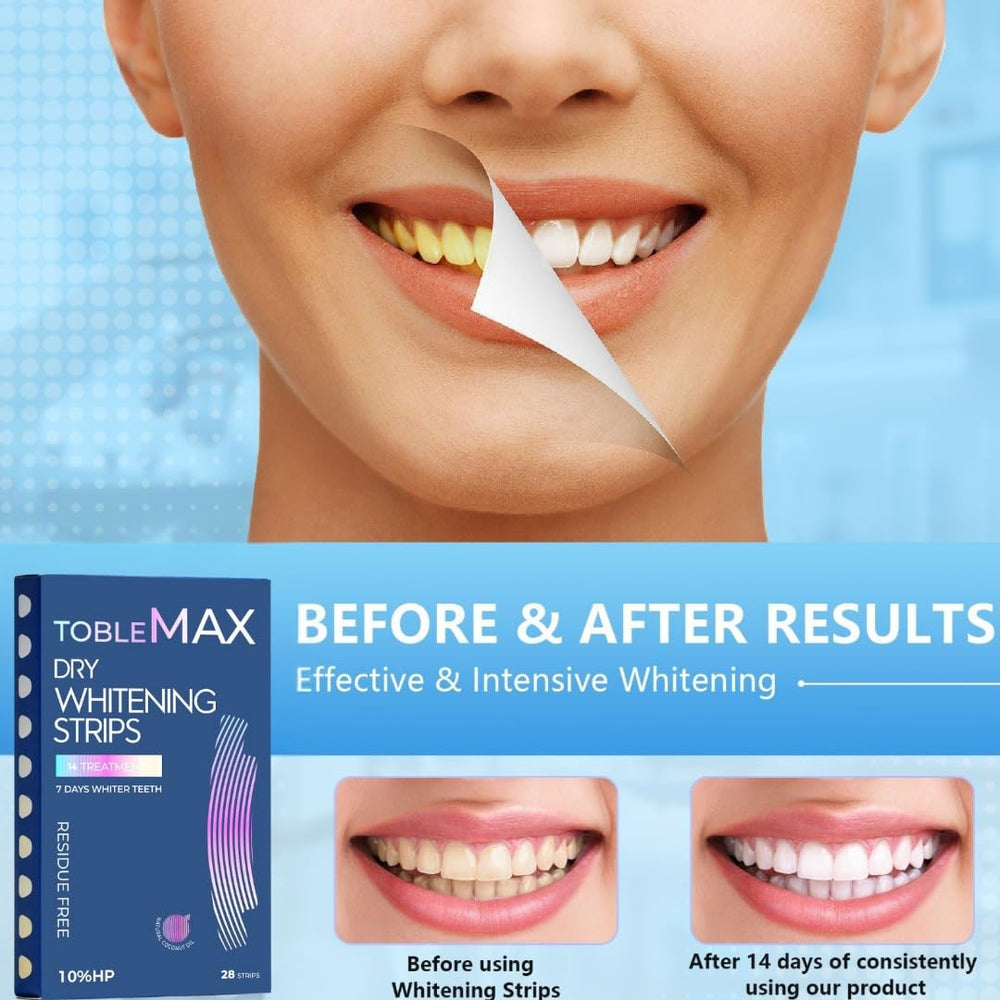 Strips applied to upper and lower teeth during whitening
