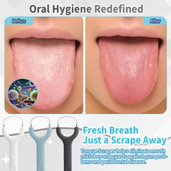 Yellow tongue scraper from the 3-pack set