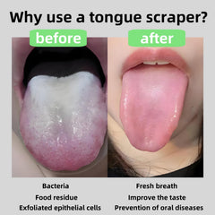Rust-proof 410 stainless steel tongue cleaner with sparkling crystals