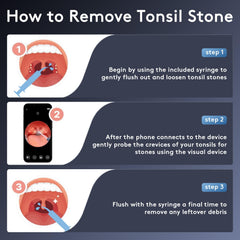 LED light and camera enable visual tonsil stone removal