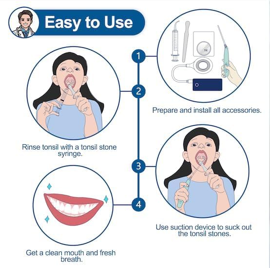 12-in-1 tonsil stone removal kit components