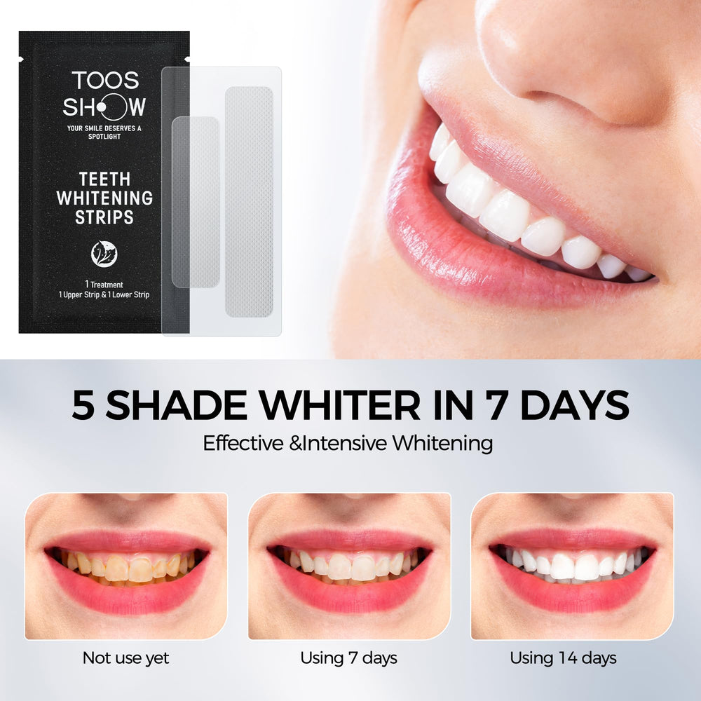 Whitening strip placed on upper teeth for demonstration