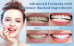 Tooth enamel protection and remineralization concept