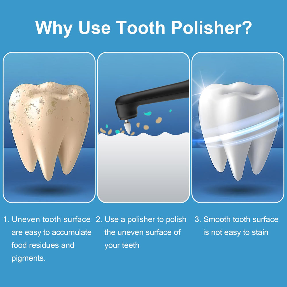 Side view of compact black SIQUER Tooth Polisher