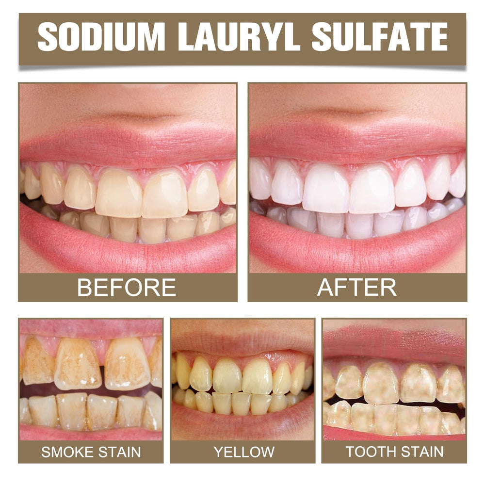 Stain removal on teeth from coffee and tea